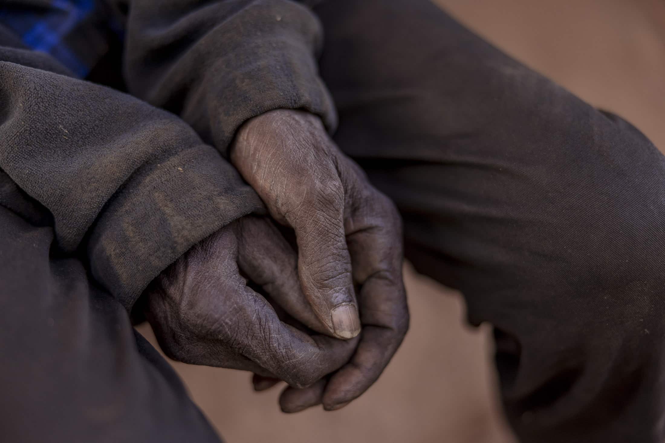 Nahaufnahme der Hände einer Person, die auf ihrem Schoß ruhen und deren Finger ineinander verschränkt sind. Die Hände und die Kleidung wirken schmutzig und abgenutzt, was auf harte körperliche Arbeit hindeutet. Das Foto fängt einen Moment der Stille und Erschöpfung ein. © Fotografie Tomas Rodriguez